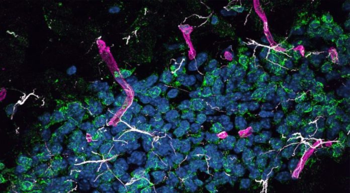 Curtin’s Alzheimer’s breakthrough
