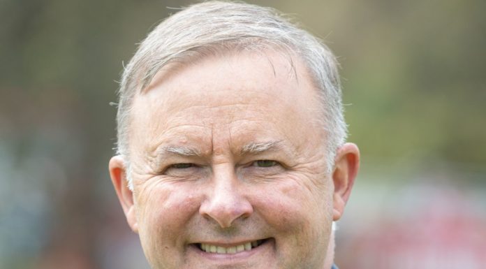 Albanese tests positive for COVID